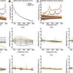 Novel algorithm improves intracranial EEG accuracy to improve future patient care