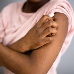 Racial differences identified in frequency of biopsy for psoriasis