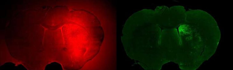 Rice lab pioneers noninvasive measurement of gene expression at target locations in the brain