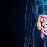 Study compares surgical techniques for crohn disease