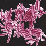 Mycobacterium tuberculosis