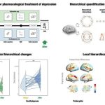 Treating depression with psilocybin or escitalopram results in different hierarchical brain reconfigurations