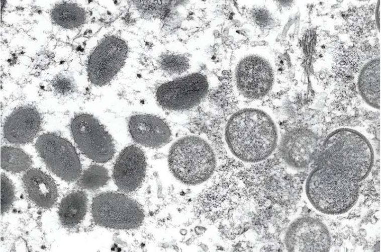 What is mpox? A microbiologist explains what's known about this smallpox cousin