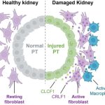 New study shows cells get involved in unhealthy relationships after acute kidney injury (AKI) in mice