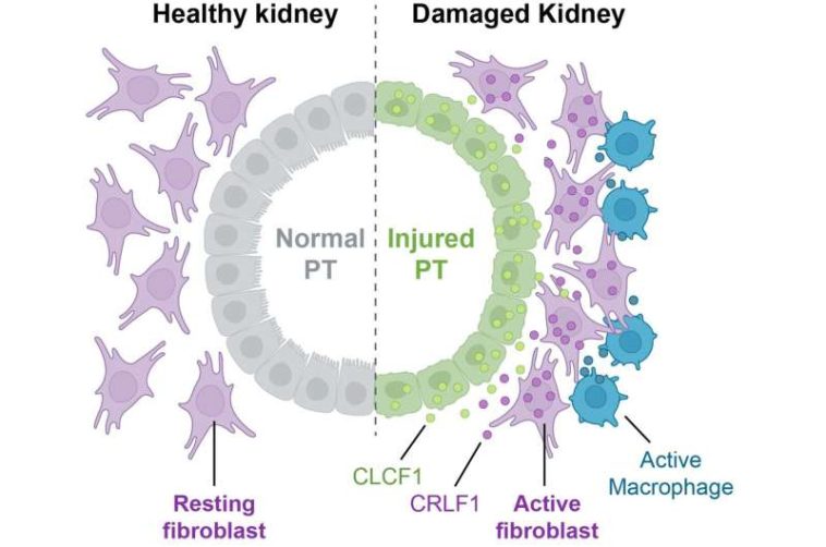 New study shows cells get involved in unhealthy relationships after acute kidney injury (AKI) in mice