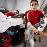 Over 22,500 have suffered ‘life-changing injuries’ in Gaza: WHO