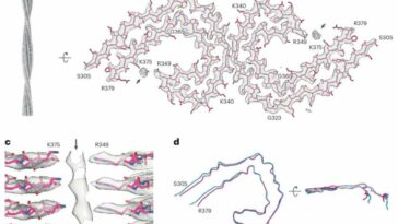 Study explores the association between Tau filaments and extracellular vesicles in Alzheimer's disease