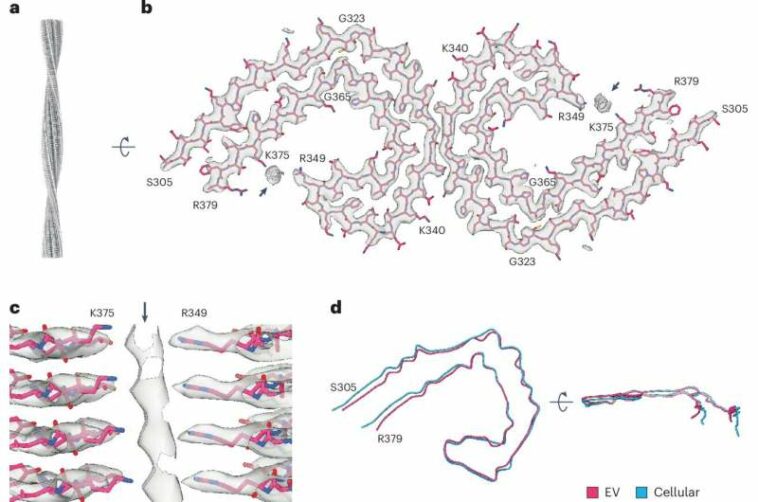 Study explores the association between Tau filaments and extracellular vesicles in Alzheimer's disease