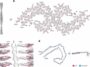 Study explores the association between Tau filaments and extracellular vesicles in Alzheimer's disease