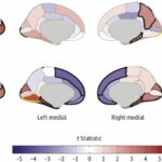 Does substance use change brain's structure, or does brain structure predispose some to substance use?