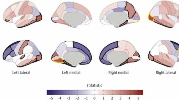 Does substance use change brain's structure, or does brain structure predispose some to substance use?