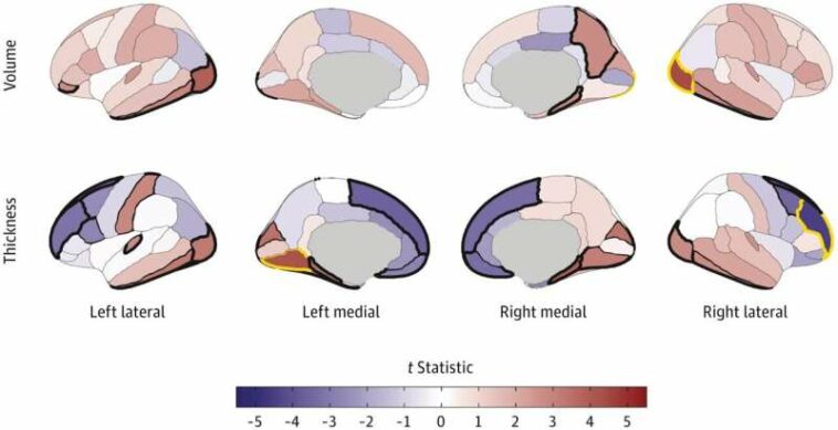 Does substance use change brain's structure, or does brain structure predispose some to substance use?