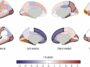 Does substance use change brain's structure, or does brain structure predispose some to substance use?