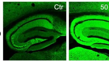 Compound found in common herbs inspires potential anti-inflammatory drug for Alzheimer's disease